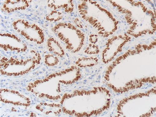3780B | Control Slides:Immunopathology;Thyroid Transcription Factor (TTF-1)
